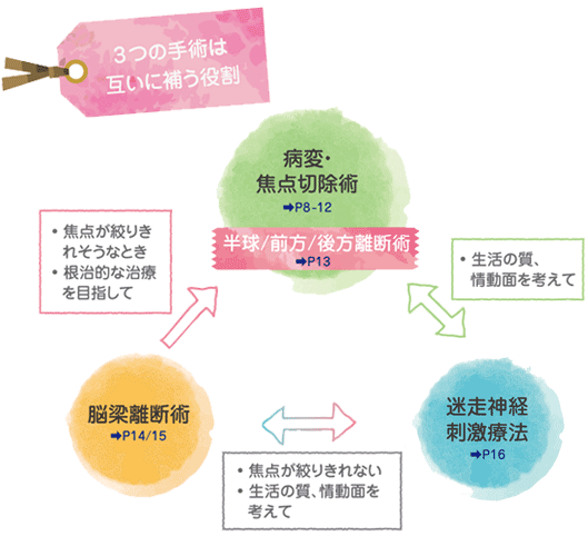「3つの手術は互いに補う役割」病変・焦点切除術／脳梁離断術／迷走神経刺激療法